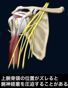 整体 手の痺れ