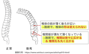 中腰で腰痛があり足まで痺れる時の原因と対処法