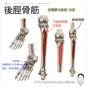 足底筋膜炎　後脛骨筋