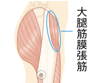 整体 大腿筋膜張筋