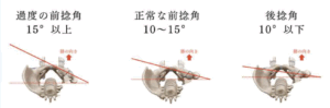 整体 前捻股