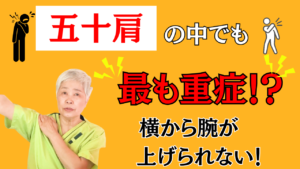 五十肩 整体 横から腕が上がらない