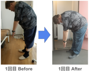 整体 腰痛 前屈できない