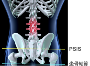 整体 PSIS